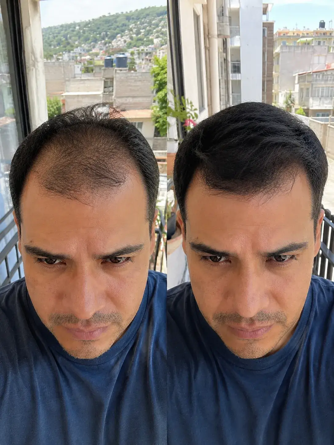 Resultado 4